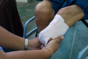 How McGuire Law Firm Can Help with Your Amputation Injury Case