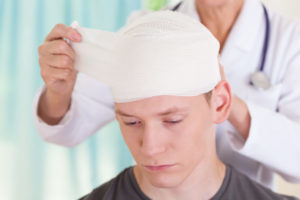 How McGuire Law Firm Can Help with Your Concussion Injury Case