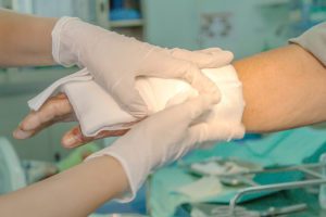 How McGuire Law Firm Can Help With a Burn Injury Claim in Oklahoma City