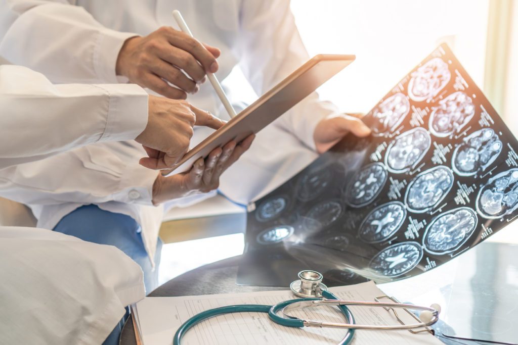 Types of Brain Injuries and Severity Levels | McGuire Law Firm